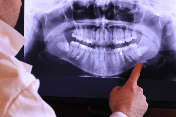 Best Cosmetic Emergency Dentistry in Ellitt, CO